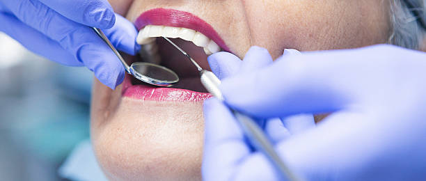 Best Emergency Wisdom Teeth Removal in Delavan, IL